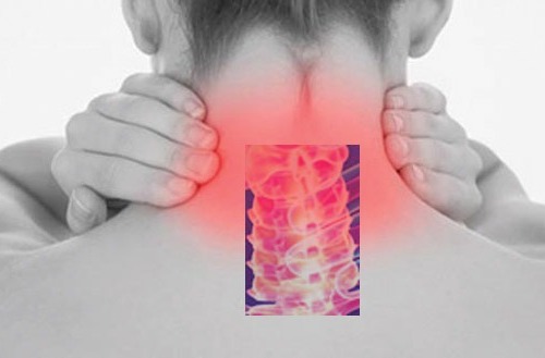 Male alle cervicali a causa del cuscino errato?